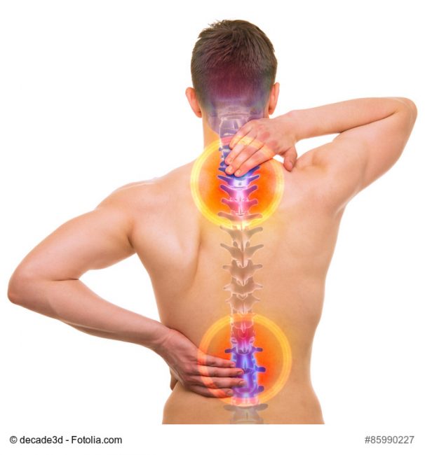 treating-a-pinched-nerve-spine-scoliosis-specialists